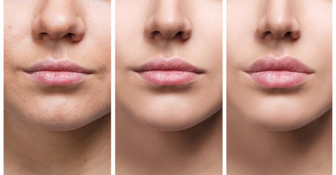 LipPlump™ - Vollere & gesündere Lippen (1+1 GRATIS)