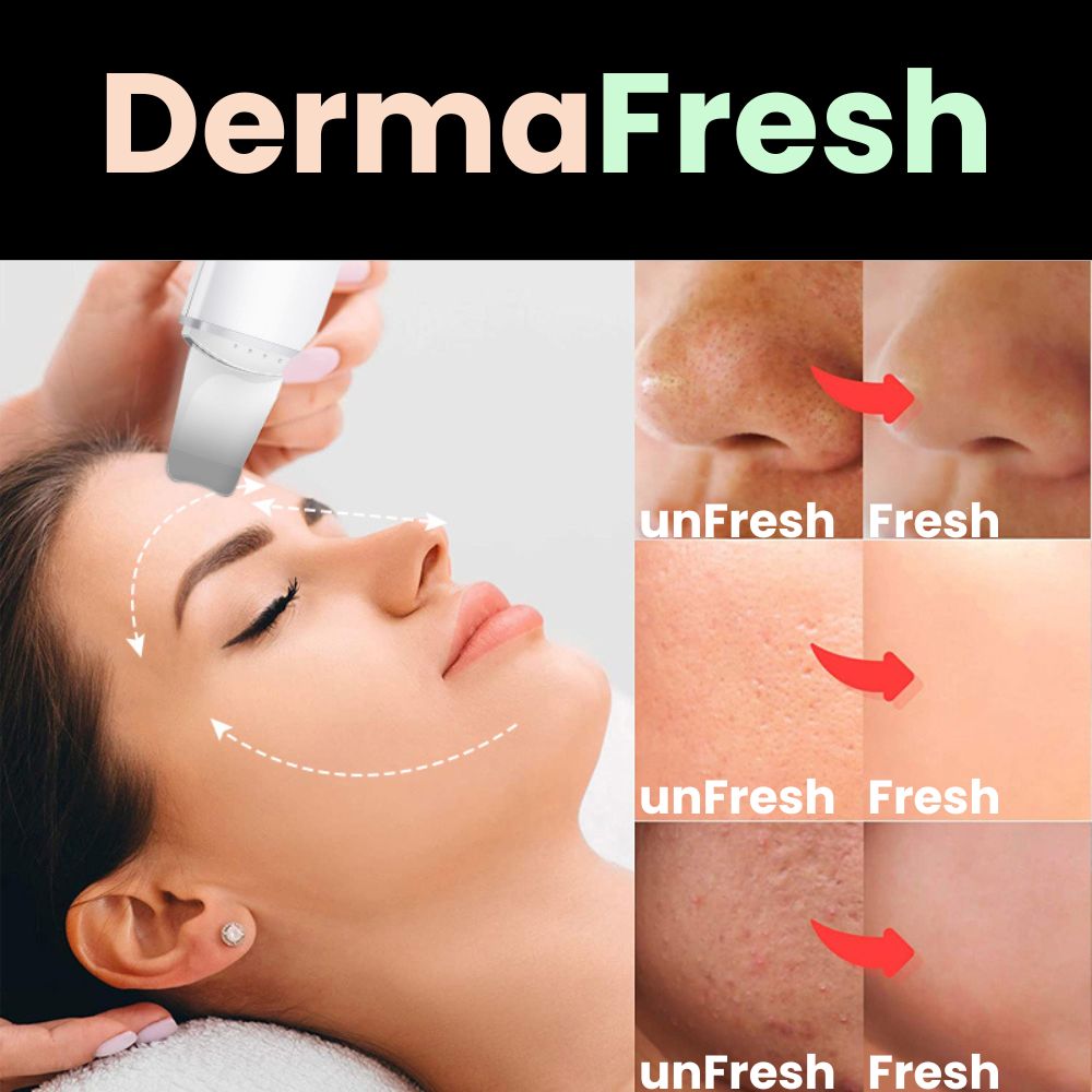 DermaFresh | Hautpflege ohne Kompromisse (50% RABATT)