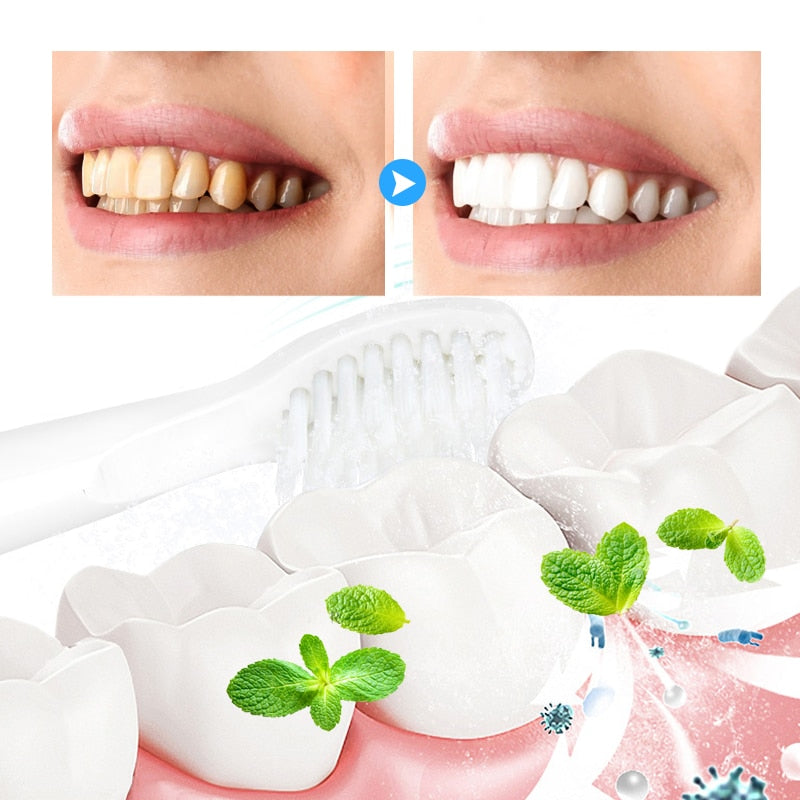ZahnWeiß Mousse - Weißere Zähne einfach und schnell! (JETZT 1+1 Gratis)