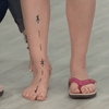Limbado's Orthopädische Sommersandalen (50% Rabatt)