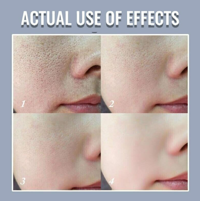 (1+1 Gratis) FreshSkin™ Pore Invisible Cream l Pflege deine Haut!