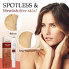 1+1 Gratis | Spotless™ Tags & Maulwurfsentferner