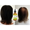BlackRice™ HAIRGROWTH  HAAR ÖL 1+1 GRATIS