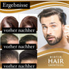 BlackRice™ HAIRGROWTH  HAAR ÖL 1+1 GRATIS