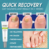 Nail Repair | Schnelle und effektive Ergebnisse! 1+1 GRATIS!