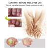 Nail Repair | Schnelle und effektive Ergebnisse! 1+1 GRATIS!